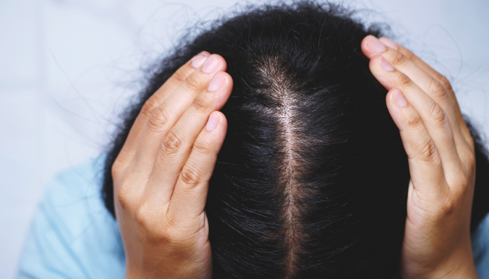 PRP hair treatment in Raipur